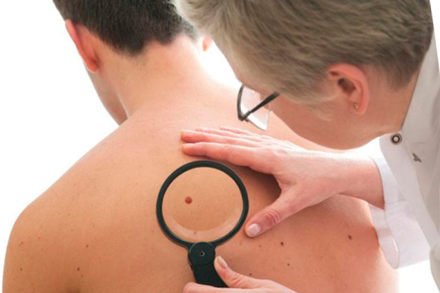 Заболевания кожи